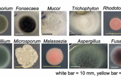 Nuovo studio pubblicato su Nature: le mascherine un crogiolo di funghi e batteri patogeni